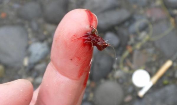 Ouch !